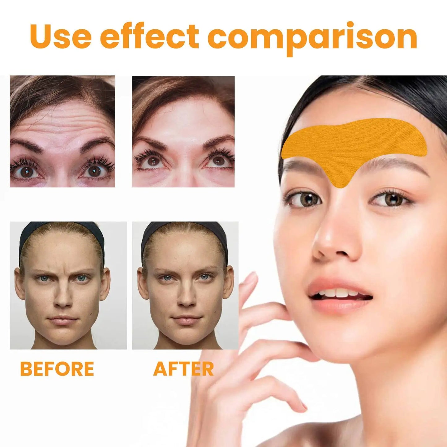 Precision Forehead Wrinkle Correction Patches